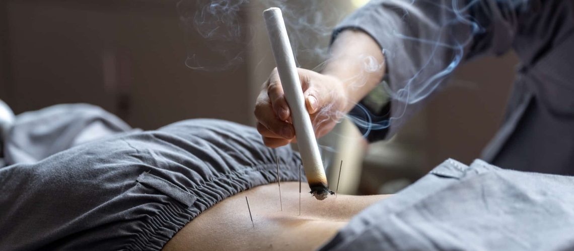 A man is doing TCM acupuncture and moxibustion and moxibustion treatment